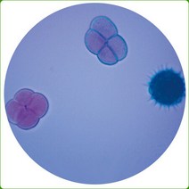 화분(꽃가루) 프레파라트, 상세페이지 참조