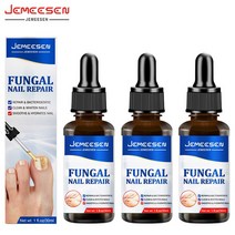 무좀 내성발톱 발톱무좀 JEMEESEN 네일 곰팡이 치료 발 관리 에센스 손톱 제거 세럼 젤 감염 방지 진균증, 02 3PCS Nail Oil
