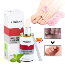 [국내배송] LANBENA 무좀 발톱무좀약 발톱무좀 치료 조갑사상균증 치료, 15ml, 2개