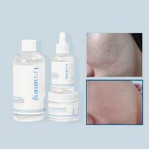 르카밍 티트리 시나몬 히알루론산 진정 3종세트 1세트, 3개