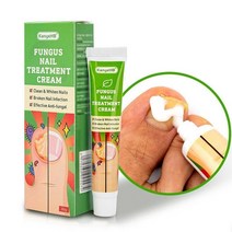 발 바닥 손 발톱 풋 각질 굳은살 케어 제거 크림 연화제 스프레이 nail fungus treatment cream removal nail ointment feet 화이트닝