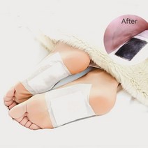 수액시트 100매 대용량 발바닥 풋패치 발바닥통증 목초수액시트