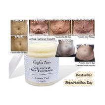 기미 잡티 크림 Cellulite & 스킨 타이트닝 Tummy Tuck Cream