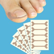 RX케어밴드 발톱 교정기