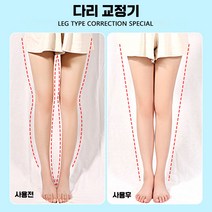 오다리 O자형 X자다리 교정기 휜다리 종아리성형, 성인 디럭스] 외반+자석 2쌍