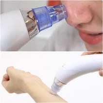 피지 흡착기 흡입기 제거기 초강력 진공 코피지뽑기 여드름 치료기 짜는도구 없애기 압출기, 전동 피지 제거기