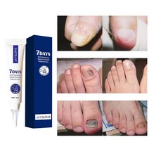 발톱무좀치료 네일 리페어 에센스 손발톱 강화 영양제, 7ml, 3개, 1개