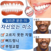 4세대 미백 틀니 실리콘 임시틀니 상하 탈착부착 고르지 못한 치열/뻐드렁니/부정교합, 4세대 미백 틀니 *4개