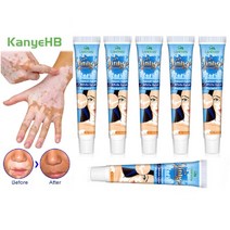 20g 허브 추출물 백반충 연고 백반암 리무브 백반점 리무브 피부 백반점 백반증 질병 리커버 크림 6 개, 01. 6pcs
