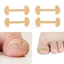 규즈몰 내성발톱 테이프 발톱 파고들때 밴드 패치 파고드는 보호대 막이 풋케어, 단품