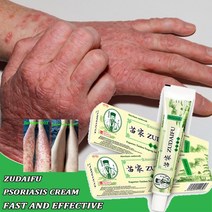 건선크림 아토피 피부습진 완화 크림 가려움방지 크림 보습제, 상자가있는 20pcs