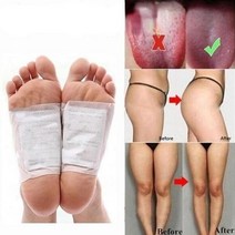 풋드랍 디톡스 풋 패치 수면 개선 슬리밍 케어 발 스티커 체중 감소 제품 효과적인 셀룰라이트 방지 지방 연소, [03] 100Pcs