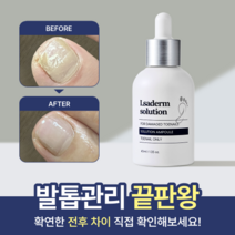 르사덤 솔루션 내성발톱 곰팡이 살균 발톱 40ml, 1개, 1개