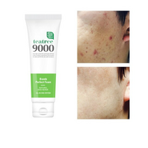 1+1 에스알픽 트러블 자국 각질 모공수축 티트리폭탄 폼클렌징 120ml, 8세트