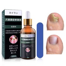 Idun 발톱무좀 손톱 발톱 진균 치료연고 발톱강화 손발톱케어 무좀 살균연고, 20g, 1개