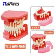 치아모형 모델 구강 교육 모델 교정 ​​모델 임플란트 모델 수복물 모델, 10 교대 유치 모델