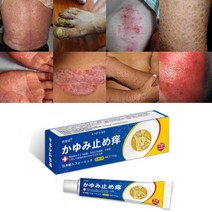 1+1 피부가려움증 두드러기 피부건선 발진 모낭염 완화 가려움증 지루성피부염 치료 연고, 15g*2, 1개