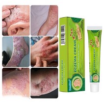 피부 가려움증 연고 습진 모낭염 두피 건선연고 지루성피부염 치료, 20ml, 2개