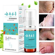 무좀 스프레이 약 발톱 각질 발바닥 발가락 간지럼 발 관리 풋케어, 55ml, 3개