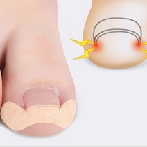 내성발톱 파고드는발톱 교정 교정기 치료 테이프 팁 30P, 내성발톱교정밴드30P
