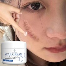 흉터 제거 연고 흉터 관리 흉터재생연고 상처흉터 수술흉터, 4개, 50g