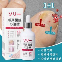 손발톱 무좀치료제 진균 리페어에센스 문제성 손발톱 손톱 발톱 케어제, 2개, 50ml