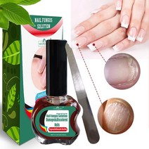 손톱 내성발톱 무좀 곰팡이 연화제 항균 큐티클 오일 에센스 치료 수리 혈청 안티 감염 paronychia onychomycosis 치료 케어 발 제거 젤