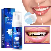 치아미백제 셀프 치아미백 치아 화이트닝 얼룩제거 구강 냄새제거, 2개, 60ml