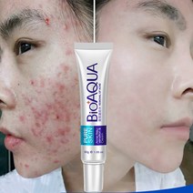 BIOAQUA 스킨 케어 얼굴 여드름 치료 흉터 크림 제거 젤 미백 보습 30g, 한개옵션0, 한개옵션0