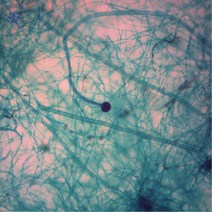 영구프레파라트/누룩곰팡이