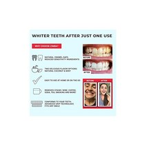 Zimba Teeth Whitening Strips - Professional-Grade Whitener Formulated for Sensitive Teeth Natural Enamel-Safe Ingredients One Mint One Wintergreen Fla