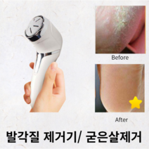 발뒤꿈치 제거기 발바닥 굳은살 제거 복숭아뼈 굳은살 없애는 기구, 각질제거기(단품)
