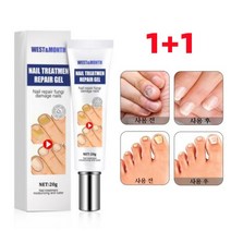 West&Month 1+1 발톱무좀치료 발톱무좀연고 네일 리페어, 2개, 20g