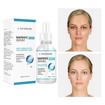 에센스 세럼 펩타이드 히알루 론산 레티놀 콜라겐 에이징 비타민 태양 반점 및 주름 감소, 없음