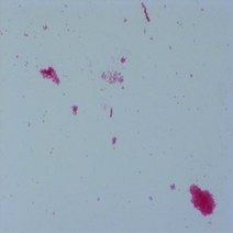 대장균(Escherichia Coli)슬라이드 BI-76