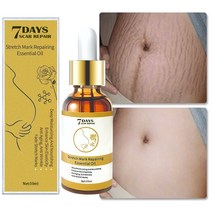 스트레치 마크 리무버 에센셜 오일 스킨 케어 트리트먼트 크림 출산 리페어 안티 에이징 링클 퍼밍 슬랙라, 04 50ml