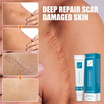 흉터 치료 크림 화상 제거 세포 재생 촉진 탄력 강화 보습 바디 스킨 케어 20g, 한개옵션0, 1개
