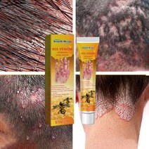 피부가려움증 연고 습진 크림 모낭염 두피 건선연고 지루성피부염 치료, 20ml, 5개