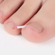 피케이몰 10P+10P 내성 발톱 통증 발톱 고정 와이어 팁, 본품10P, 1+1