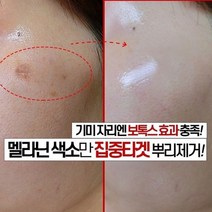 피부과 기미 잡티 보톡스 크림 피부재생 탄력 산후기미 주름