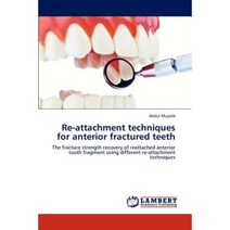 Re-Attachment Techniques for Anterior Fractured Teeth Paperback, LAP Lambert Academic Publishing