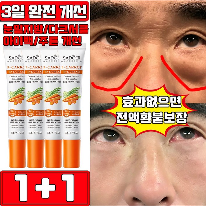 일본 1122 눈 밑 지방 제거 크림 칼슘 아이크림 아이팔트 아이백 크림 당근 아이크림 이백 비립종 눈밑 지방 제거 크림 다크서클 눈가 탄력 주름개선 사은품 랜덤 증정