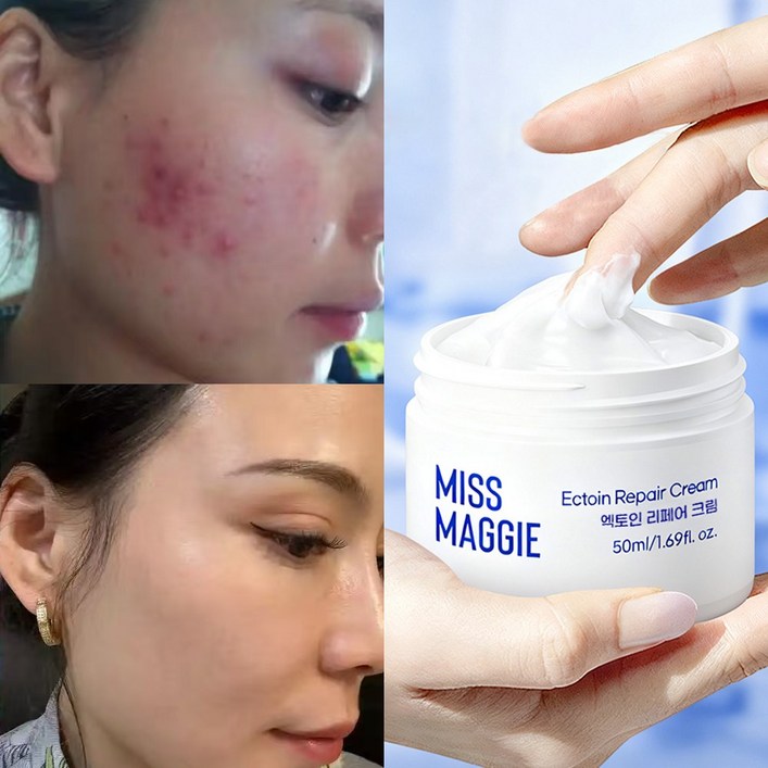 미스 매기 egf 자생크림 피부과 레이저시술 후 리페어크림