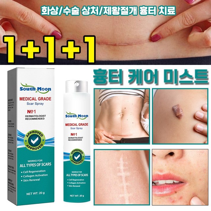 피부과 전용 흉터 제거 연고 흉터 케어 미스트 화상 물집 제왕절개흉터 수술흉터 연고 재생크림 여드름흉터 제거 스프레이 피부과 전용 흉터 제거 연고 흉터 케어 미스트 화상 물집 제왕절개흉터 수술흉터 연고 재생크림 여드름흉터 제거 스프레이