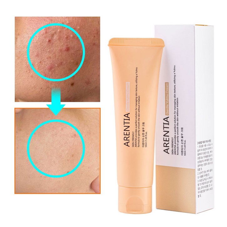 피부 요철 제거 집중 케어 율무 연고 크림 율무 60% 함유 각질 정돈 피부 진정 톤업 주름 개선 나이아신아마이드 아데노신, 1개, 50ml