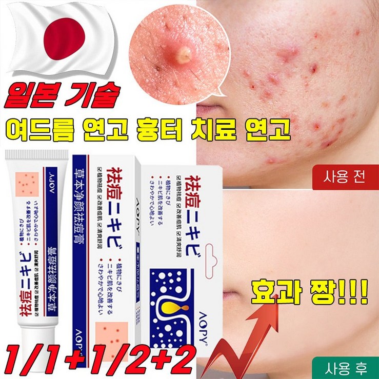 국내배송 일본 여드름 연고 흉터 치료 연고 청소년 피부 화농성 여드름 제거 리페어 연고 모공 진정 피지케어 크림